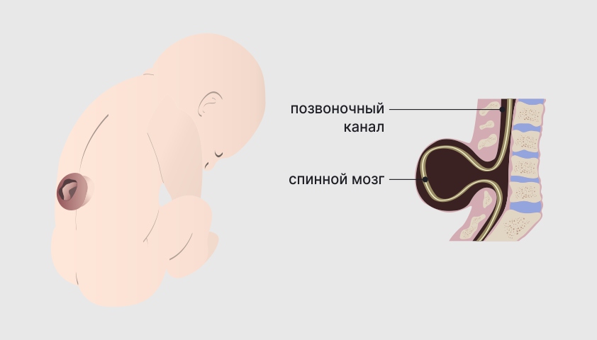 Пятая неделя беременности