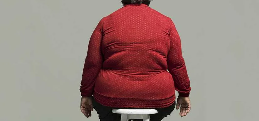 Ожирение: последствия и угрозы для здоровья