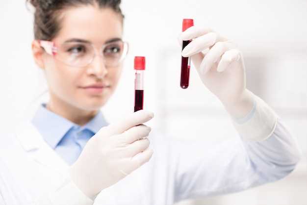 Что показывает общий анализ крови?