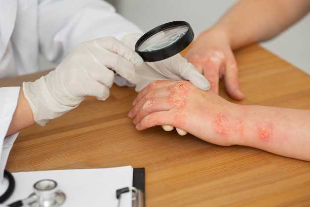 Определение аллергии через анализ крови