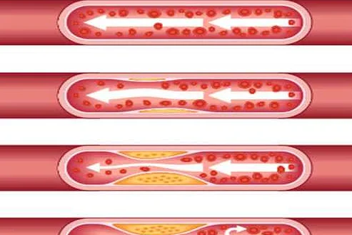 Какие органы и системы человека наиболее чувствительны к низкому уровню холестерина