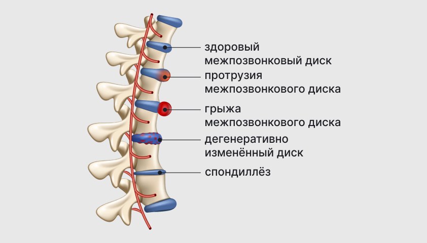 Деформации