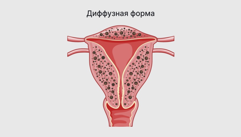 Рак кожи - симптомы, признаки, как выглядит и проявляется