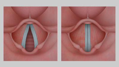 Фото голосовых связок