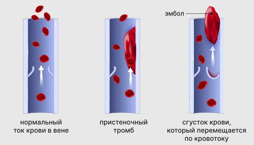 Кровеносные сосуды - что такое артерии, капилляры и сосуды