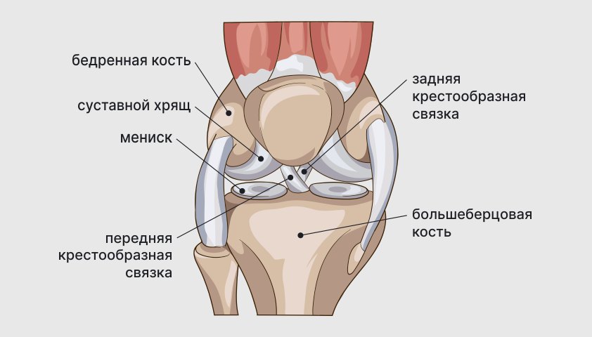 Болезнь Кёнига (рассекающий остеохондрит) — что это, причины, симптомы, лечение