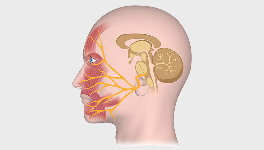 Изображение лицевого нерва
