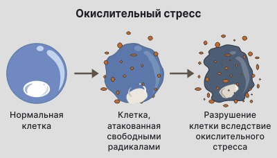 Окислительный стресс