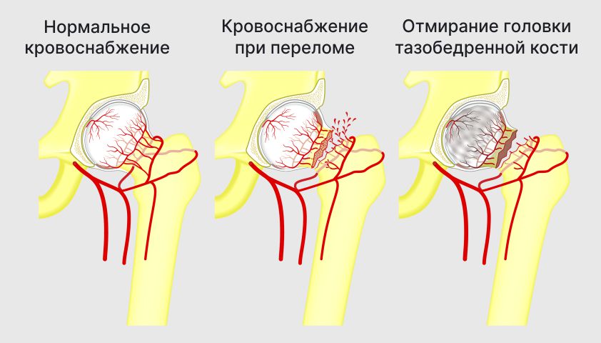 Отмирание