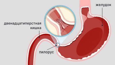 Изображение пилоруса