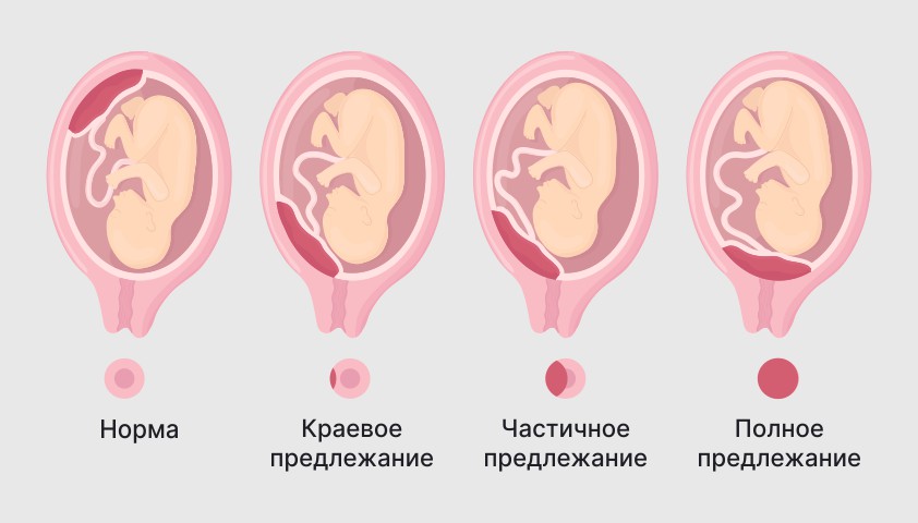 Второй триместр беременности - ответы на все вопросы