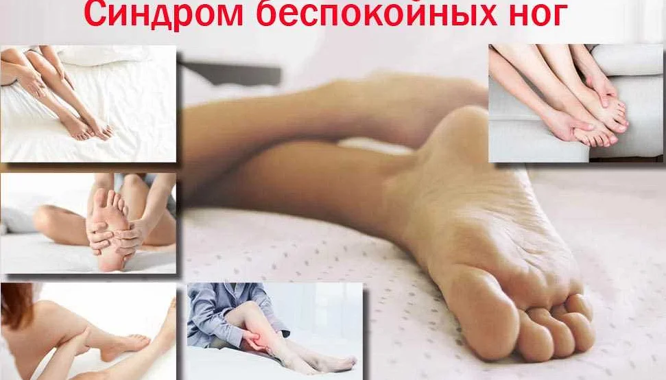 Синдром беспокойных ног: что это за заболевание?