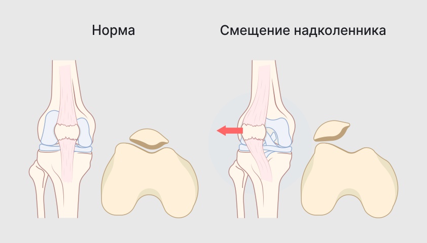 Смещение