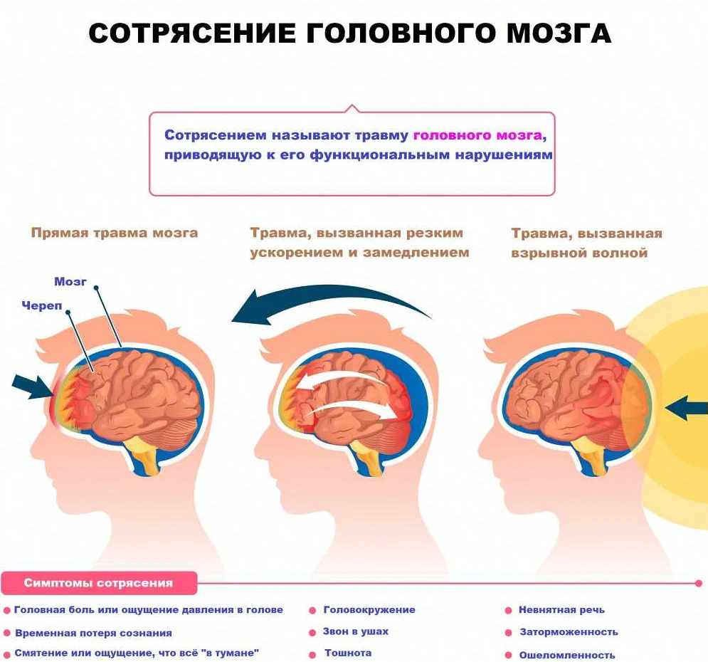 Основные принципы лечения сотрясения мозга