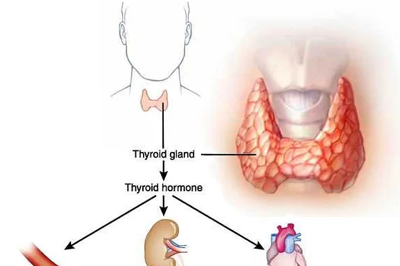 Операция щитовидной железы при тиреотоксикозе гипертиреозе: необходимость и показания