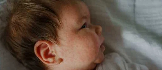 Как внести изменения в рацион ребенка при аллергии?